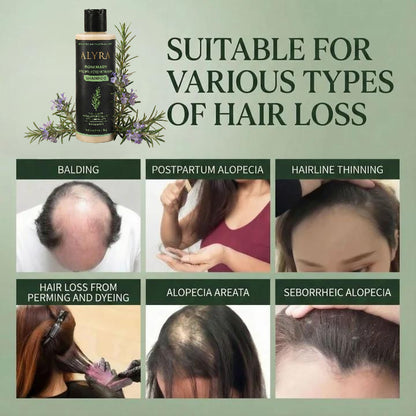 Alyra™ GROWTH SUPPORT SHAMPOO