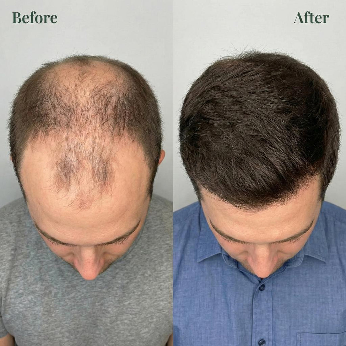 Alyra™ GROWTH SUPPORT SHAMPOO