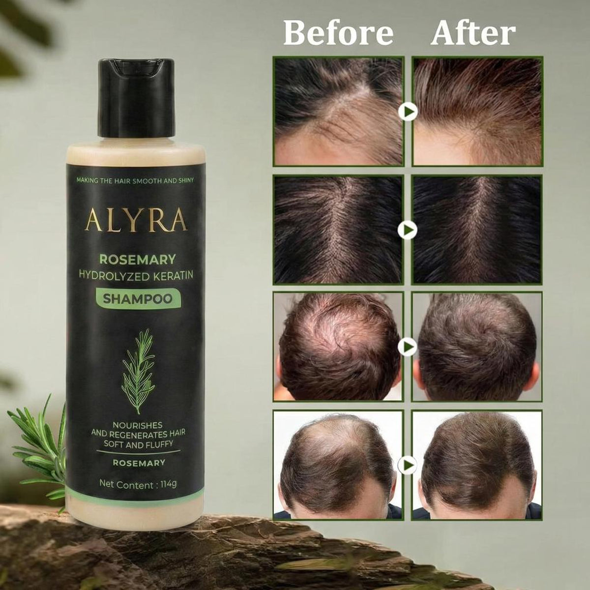 Alyra™ GROWTH SUPPORT SHAMPOO