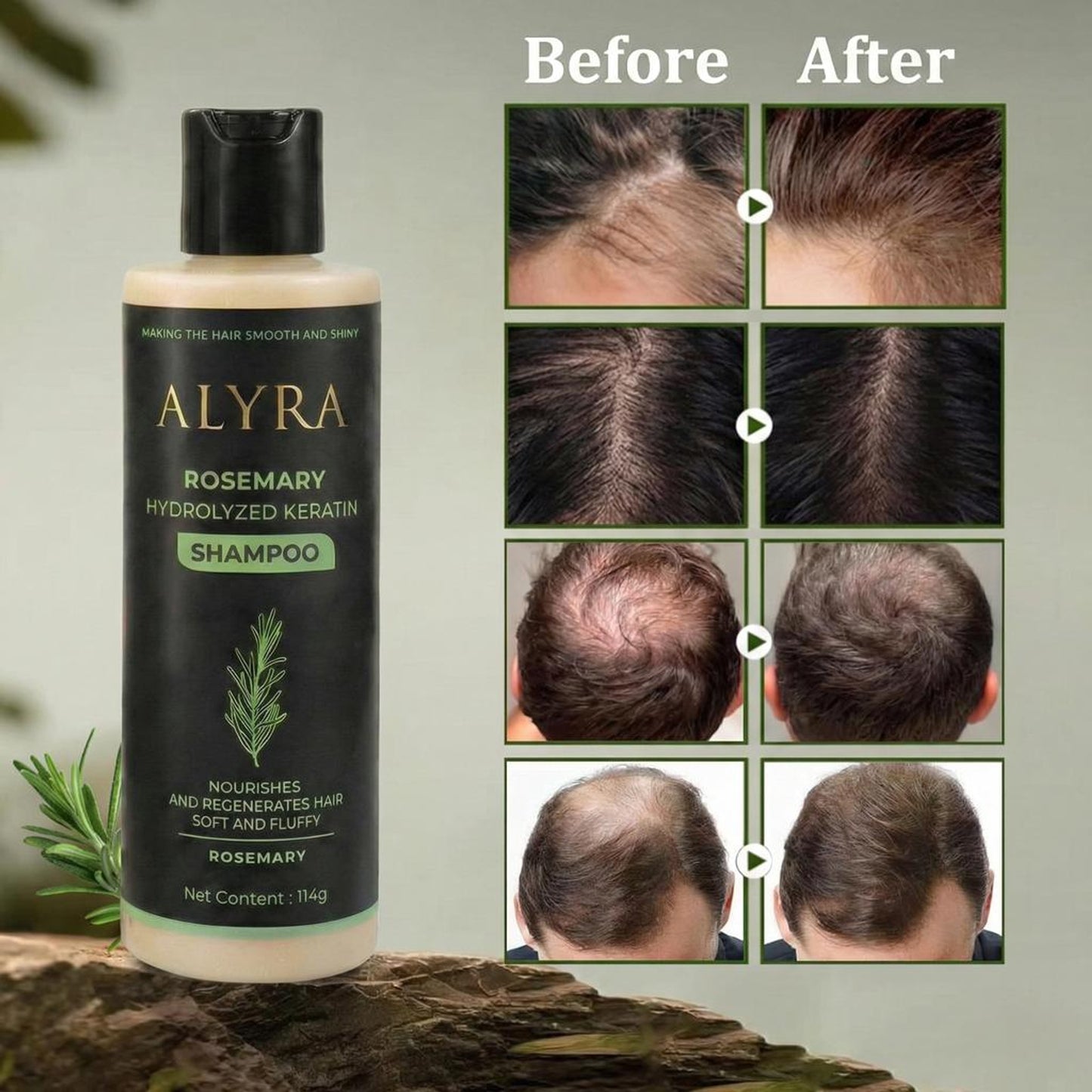 Alyra™ GROWTH SUPPORT SHAMPOO