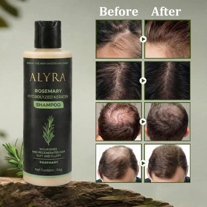 Alyra™ GROWTH SUPPORT SHAMPOO