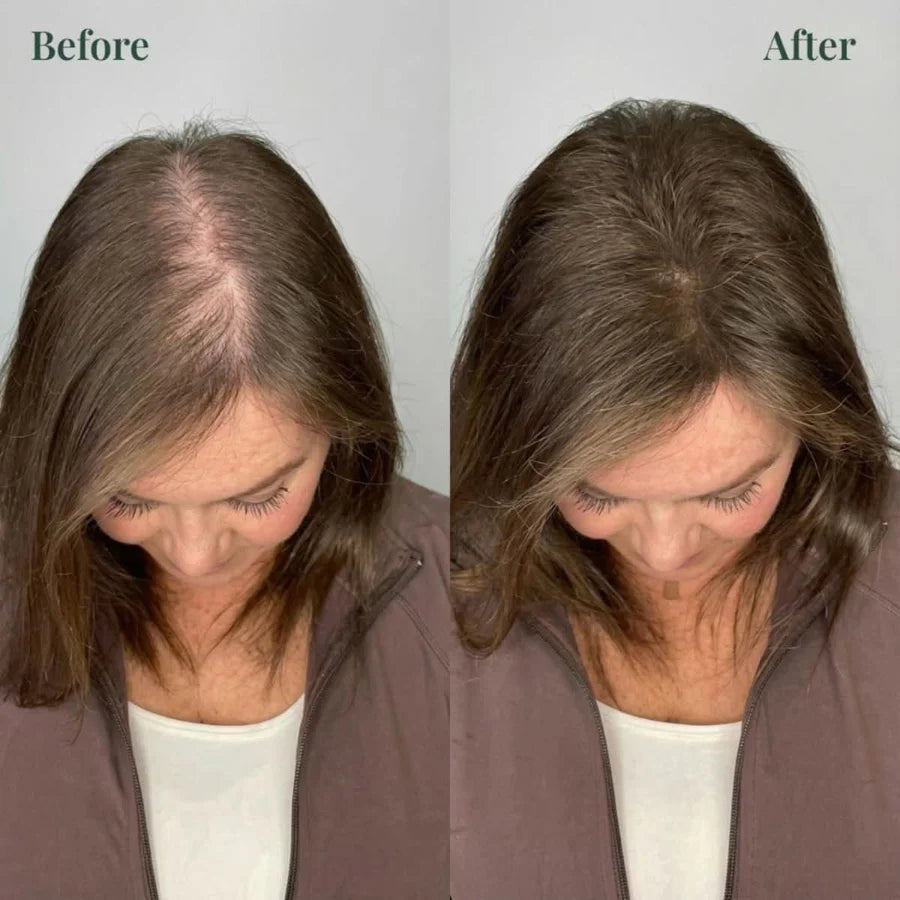 Alyra™ GROWTH SUPPORT SHAMPOO