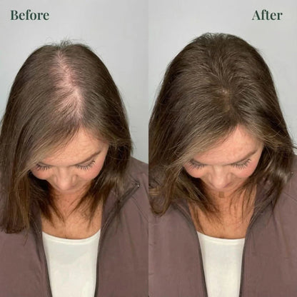 Alyra™ GROWTH SUPPORT SHAMPOO